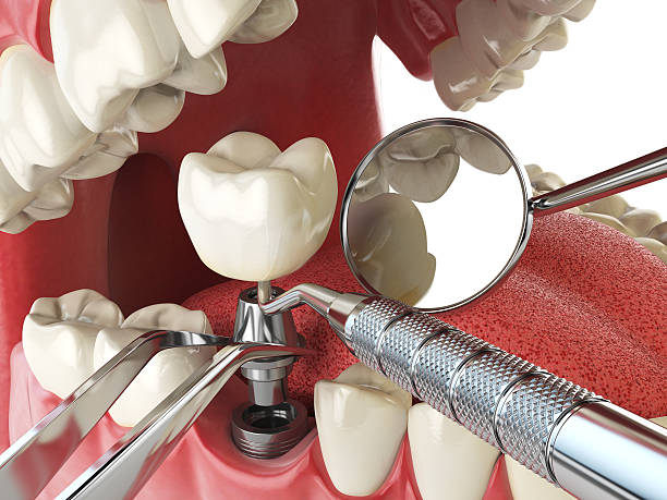 Best Knocked-Out Tooth Emergency  in Inverness, FL